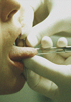 (Tongue5.gif) Picture of barbell being put into the tongue during piercing... ::Click to see how the tongue is pierced::